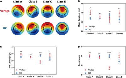 Electroencephalography Microstate Alterations in Otogenic Vertigo: A Potential Disease Marker